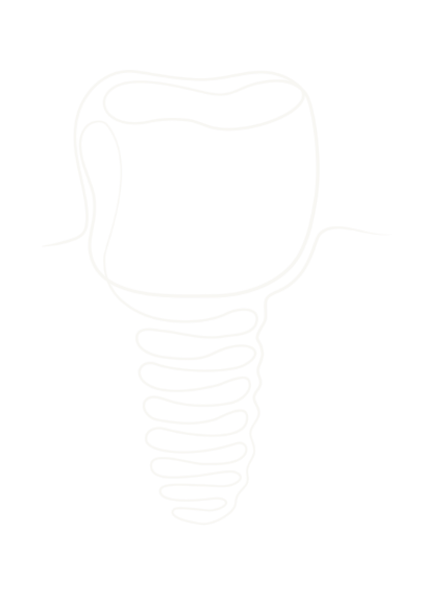 Zubní implantát — kresba jednou linkou